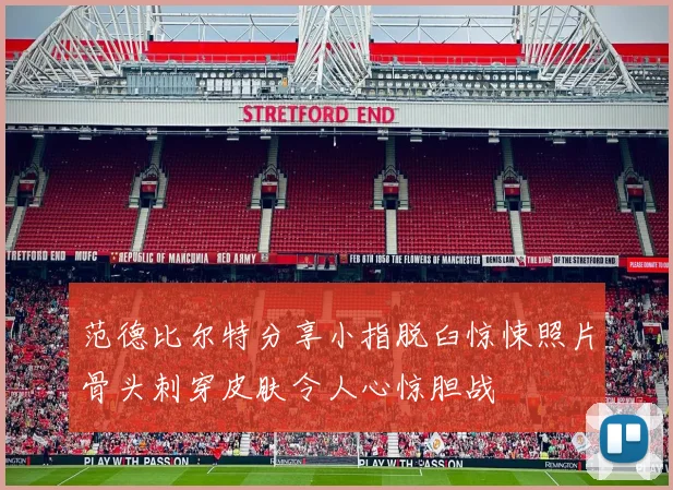 范德比尔特分享小指脱臼惊悚照片骨头刺穿皮肤令人心惊胆战